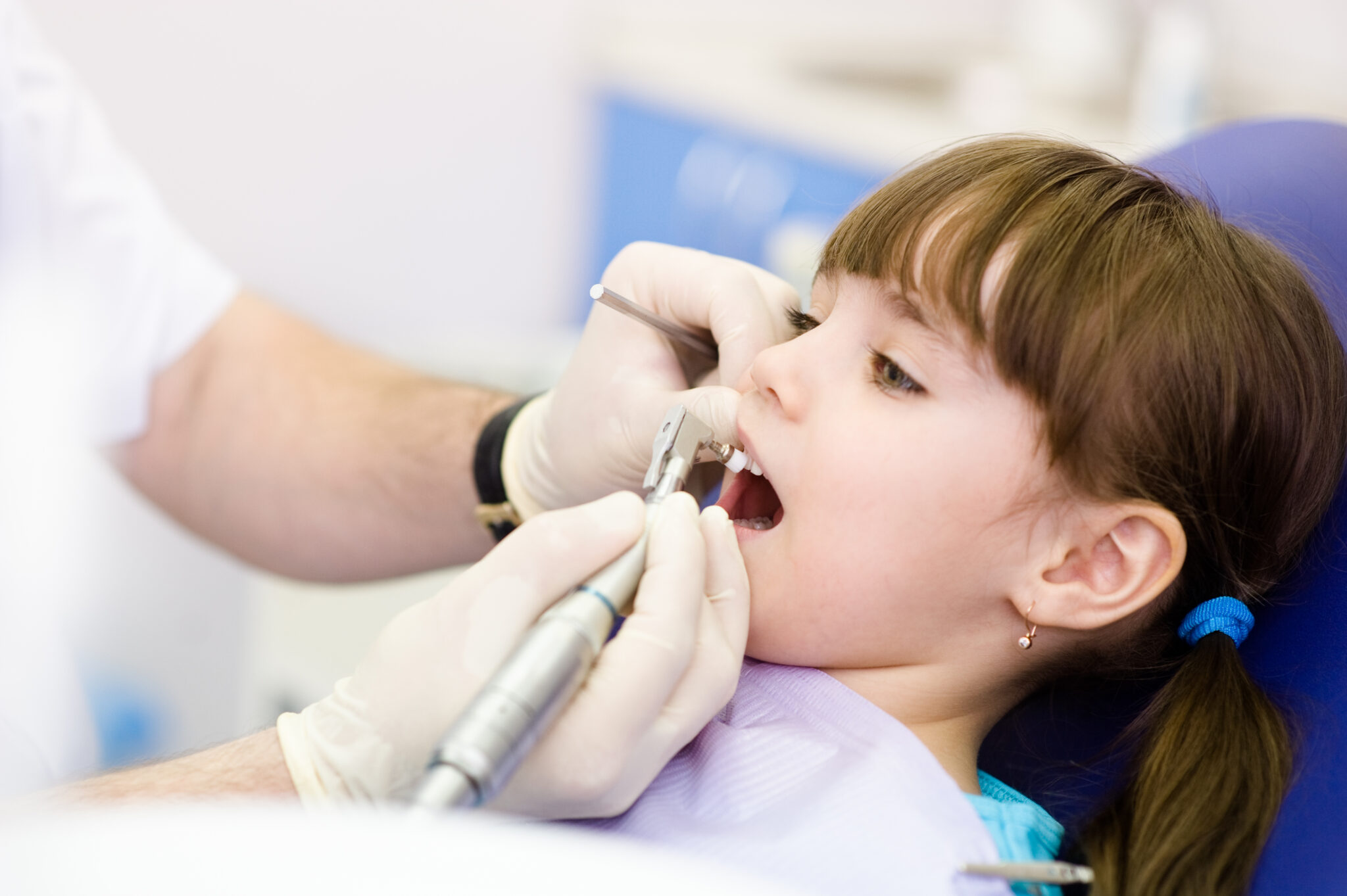 DENTAL CARIES IN CHILDREN