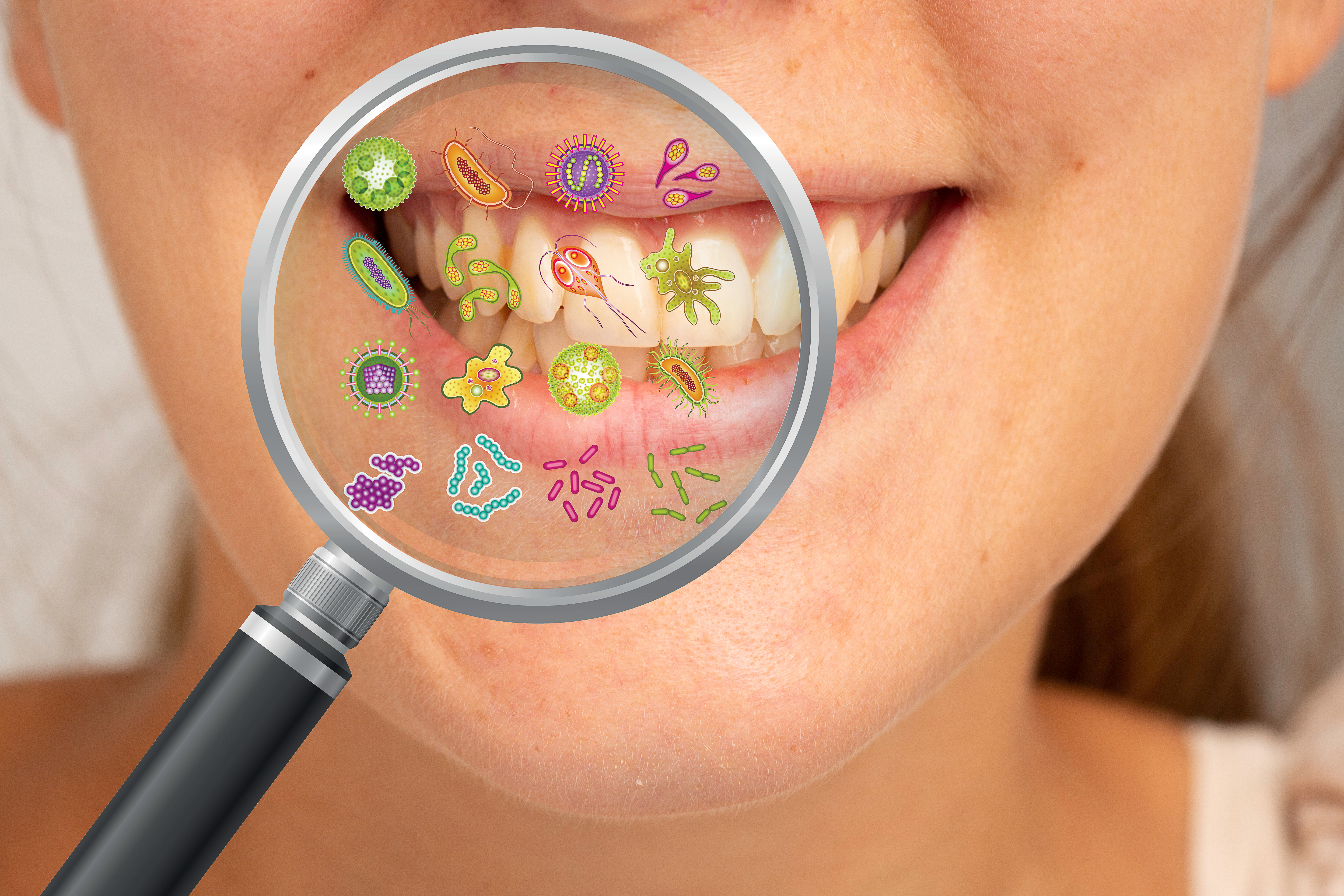 PERIODONTAL BACTERIA REDUCE ORAL DEFENSES