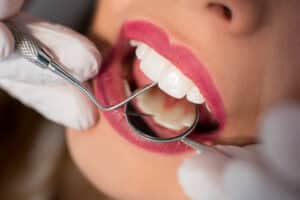 PEOPLE WHO RECEIVE PERIODONTAL CARE HAVE BETTER OUTCOMES AFTER HEART ATTACK