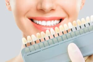 cosmetic dentistry