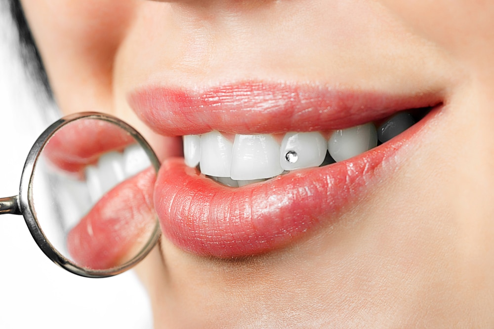 SAFETY PRECAUTIONS TO PROTECT YOUR TEETH